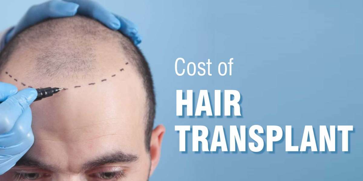 Factors that Determine Hair Transplant Cost in Mumbai