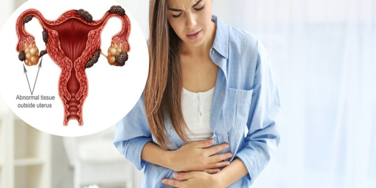 How To Cure Endometriosis Without Surgery?